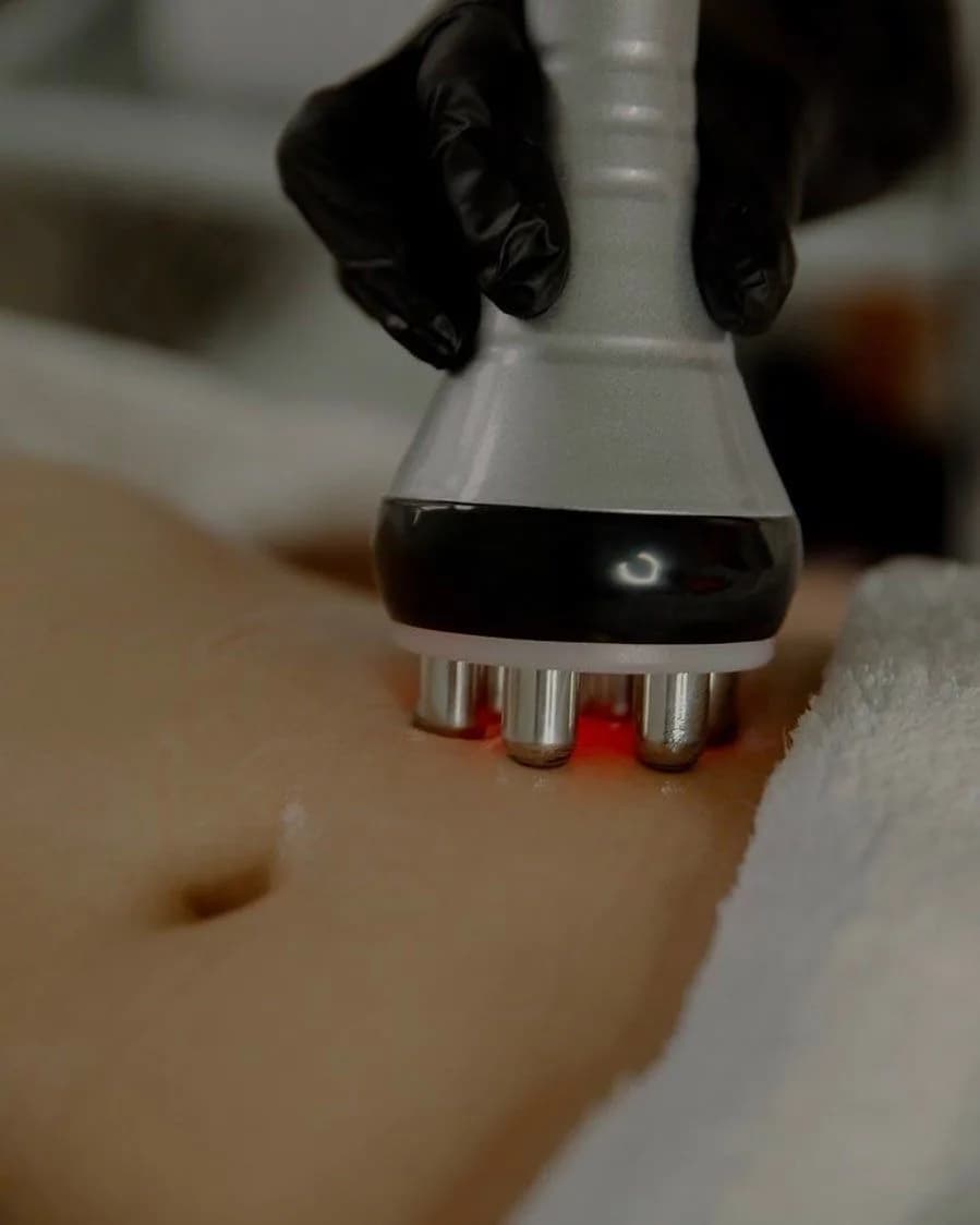 Paquetes de Reducción